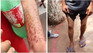 Comunidade Terapêutica é interditada e internos são encontrados dopados e com marcas de agressões 