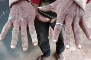 Comunidade terapêutica de MG é condenada por escravizar dependentes químicos